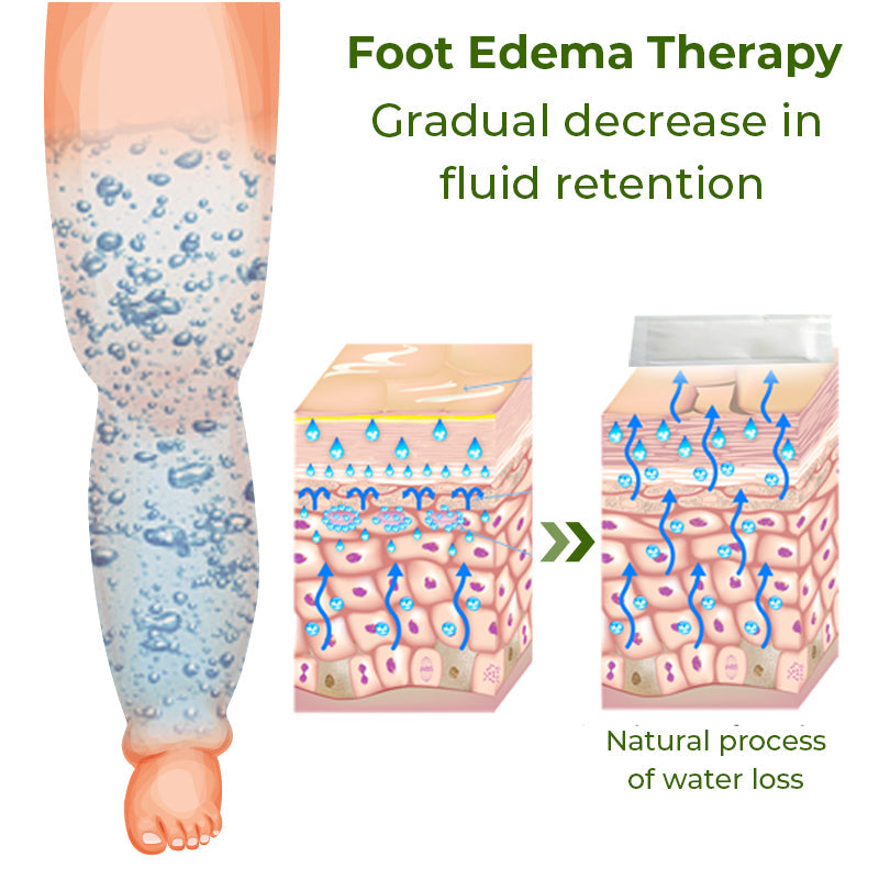 GFOUK™ Foot Edema Therapy Patch
